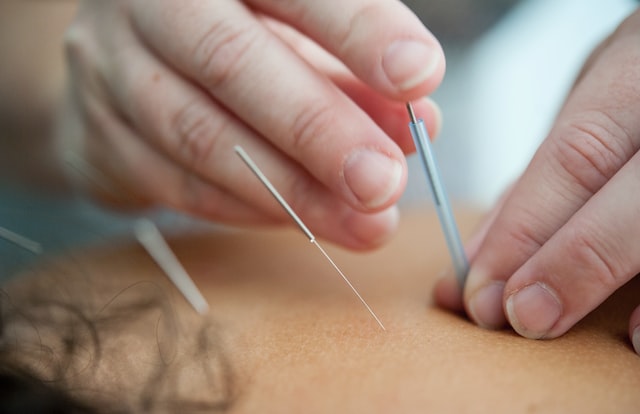 Roskilde Akupunktur